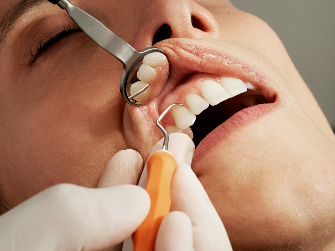 Full Mouth Rehabilitation in Chengdu: Is It Worth the 2026 Medical Trip?