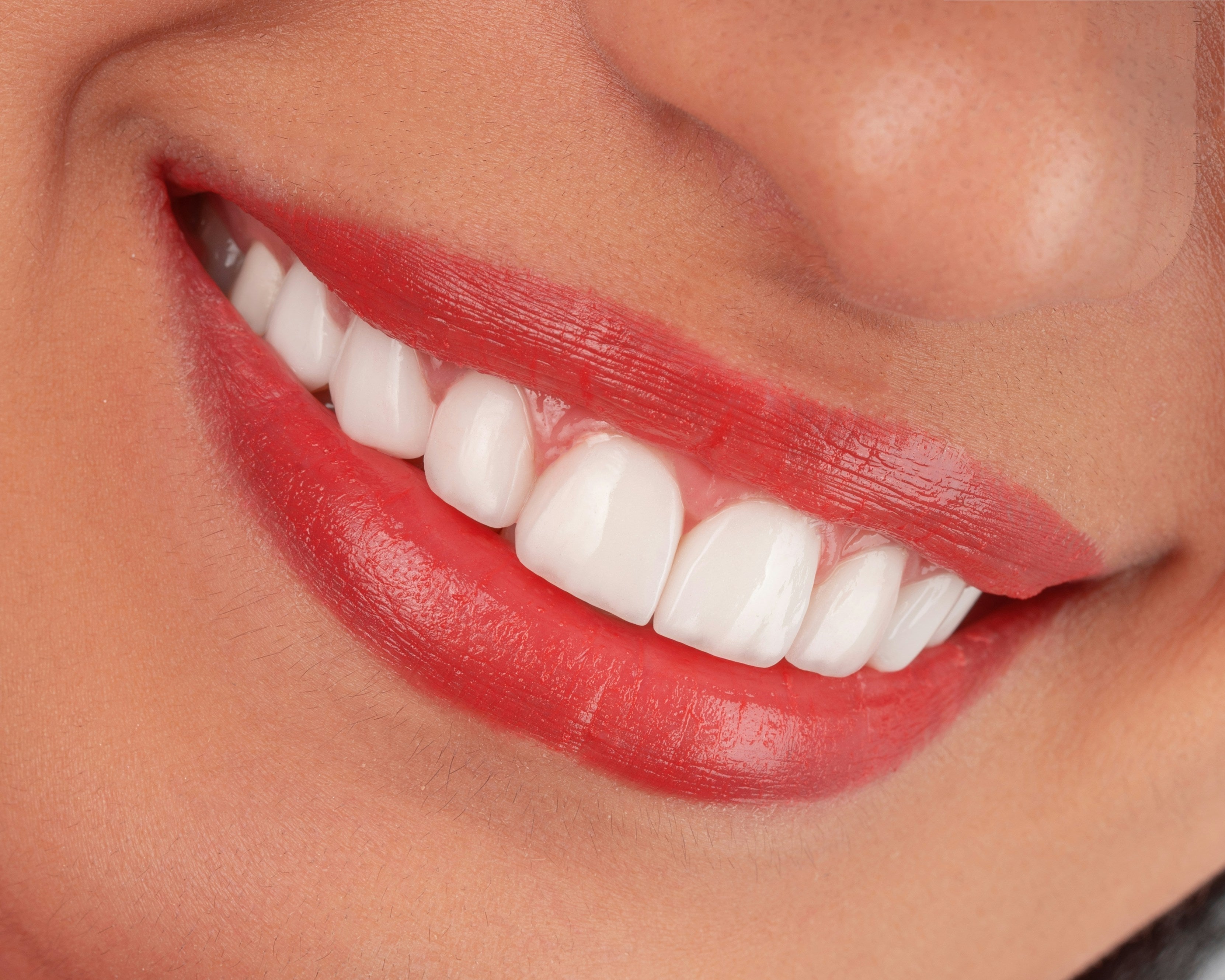 Dental Care for Fans During the World Cup: The "Red Card" for Hard Snacks & Safe Substitutions