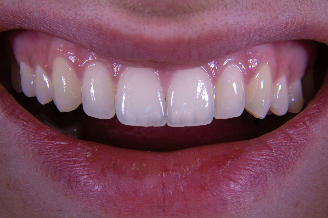 Global Dentistry News Summary: May 2026 3D Printing Breakthrough
