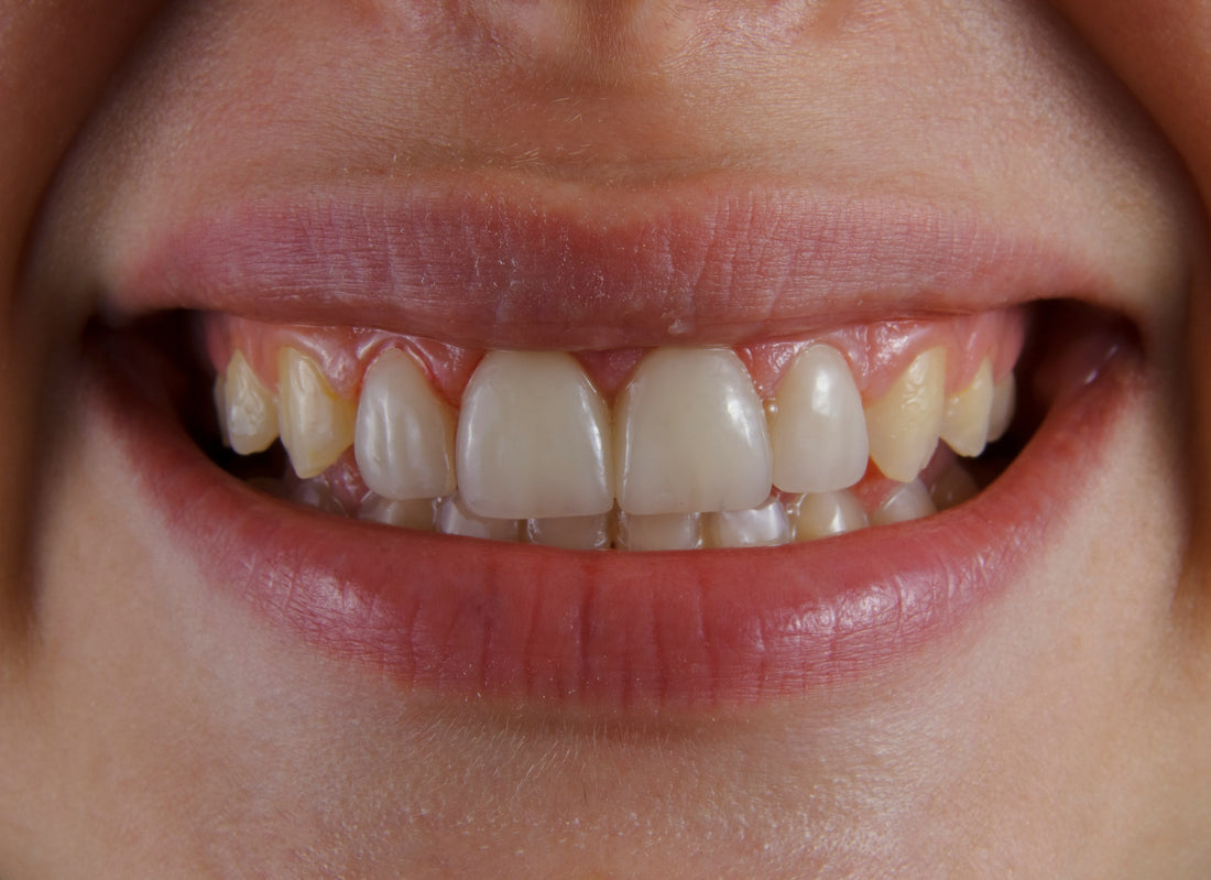 Global Dental News Summary: May 2026 Highlights,The Rise of Robotic and AI-Guided Implantology