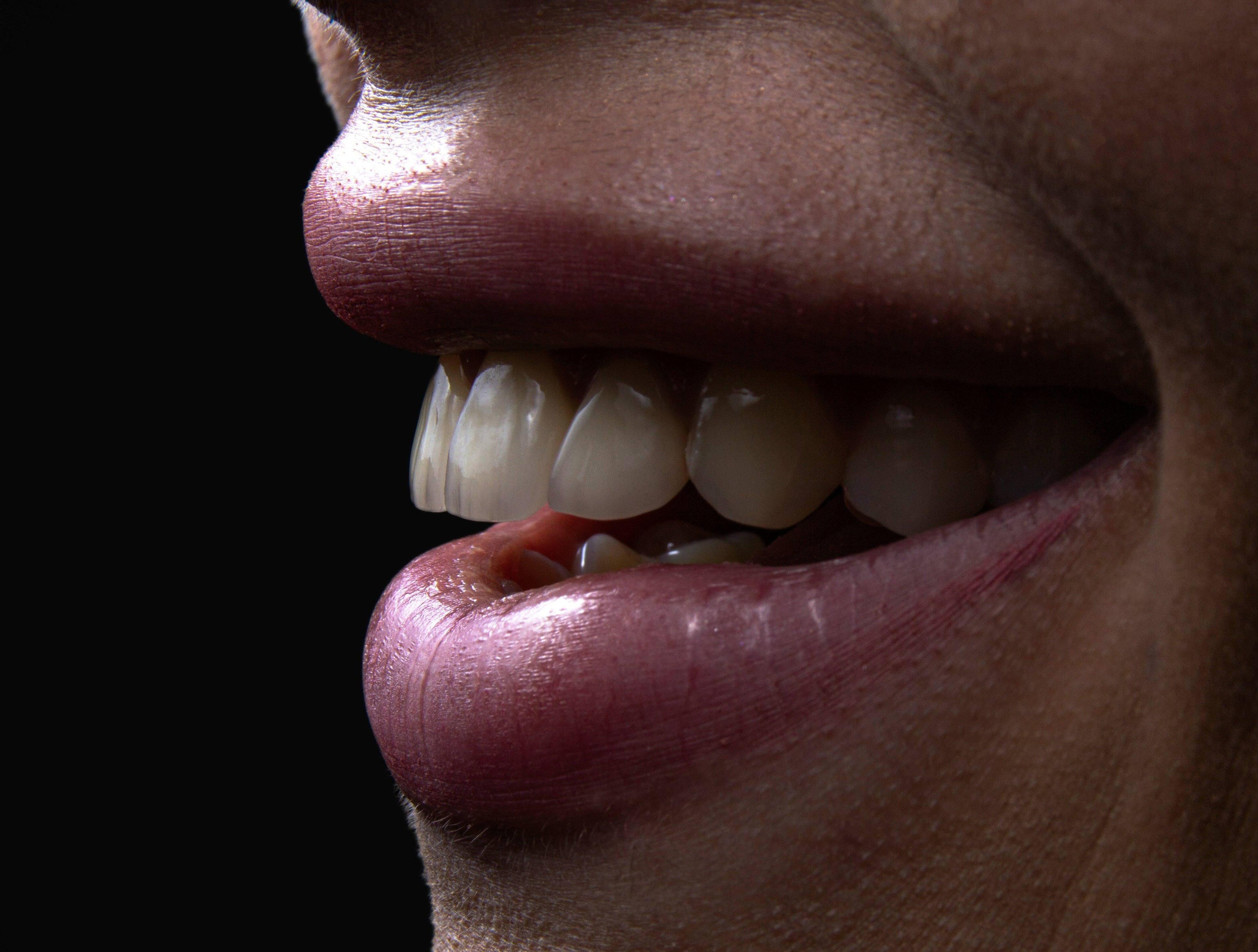 Can Your Dental Veneers Survive a Chengdu Hot Pot? Why This City is the Ultimate Test for Aesthetic Dentistry
