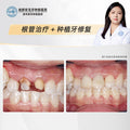 Dental Implant & Root Canal Therapy,A Combined Restorative Approach, Clinical Cases: Dr. Wang Yuanjing