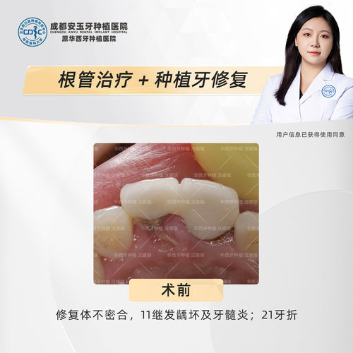 Dental Implant & Root Canal Therapy,A Combined Restorative Approach, Clinical Cases: Dr. Wang Yuanjing