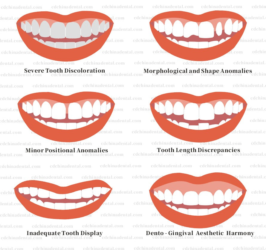 Comprehensive Restorative Solutions for Complex Structural & Color Deficiencies