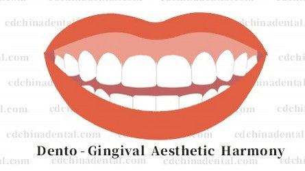 Gummy smile correction with Digital Smile Design and porcelain veneers in Chengdu, China